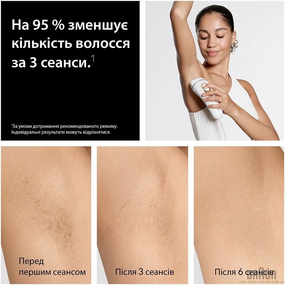 Фотоепілятор BRAUN Silk-expert Pro 5 IPL (PL5412) — фото 5